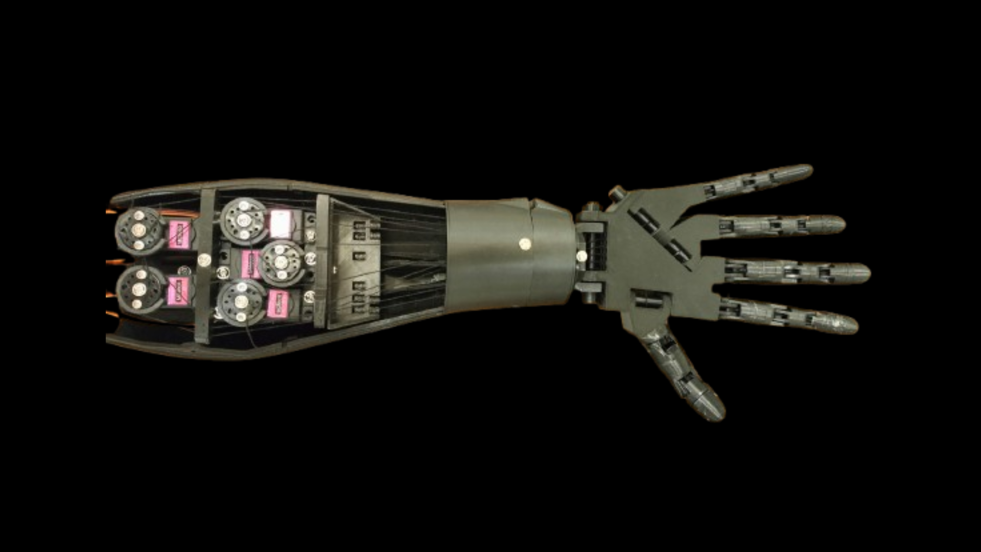 Prosthetic Arm model